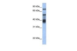 Zinc finger protein 395 Rabbit anti-Human, Polyclonal, Novus Biologicals 100 &mu;g | Buy Online | Novus Biologicals | Fisher Scientific